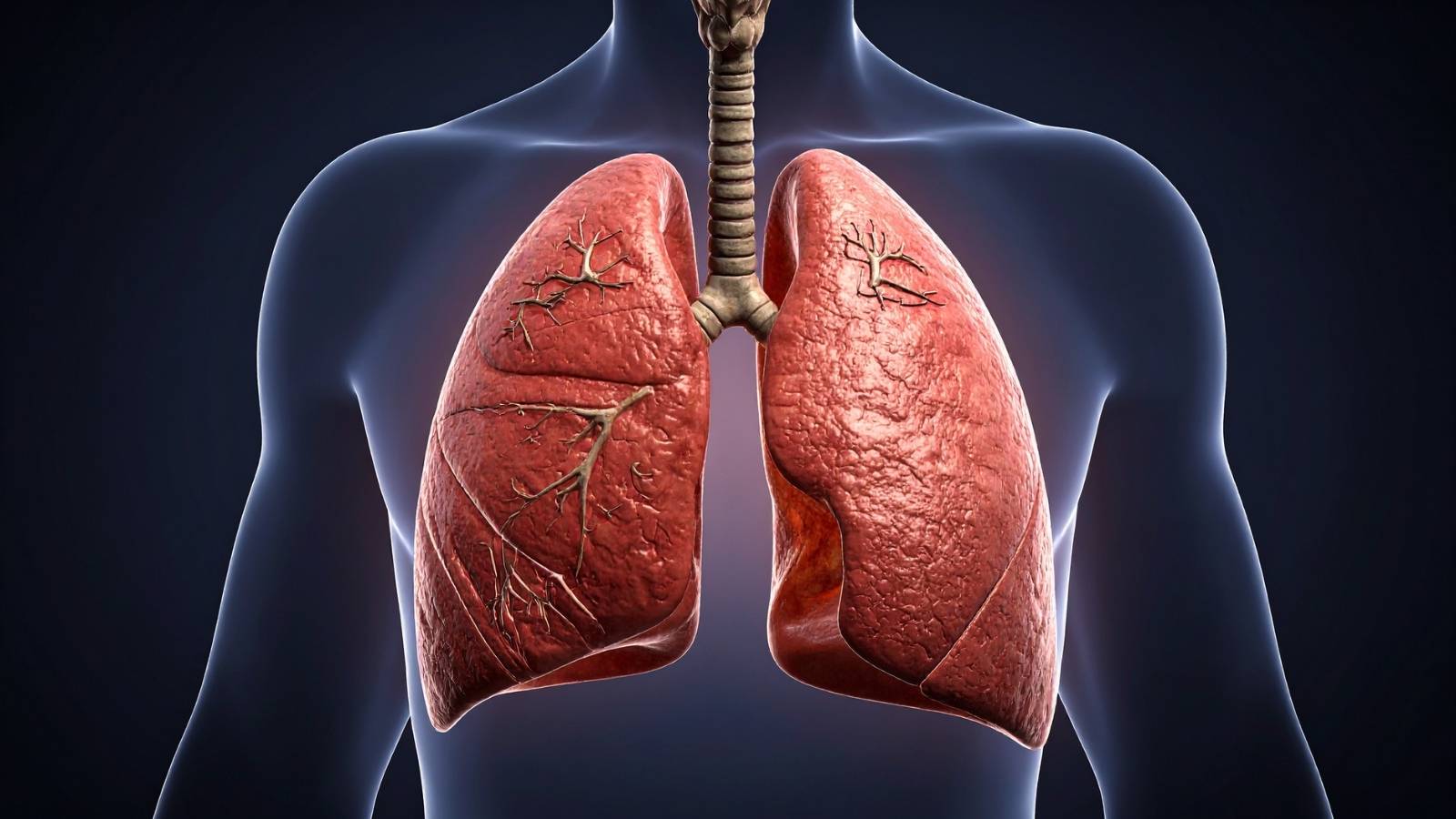 The Anatomy of a Mesothelioma